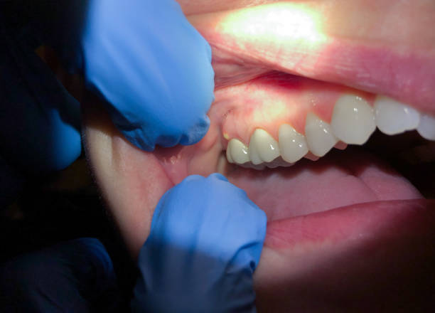 Best Emergency Root Canal Treatment in White Hall, AR