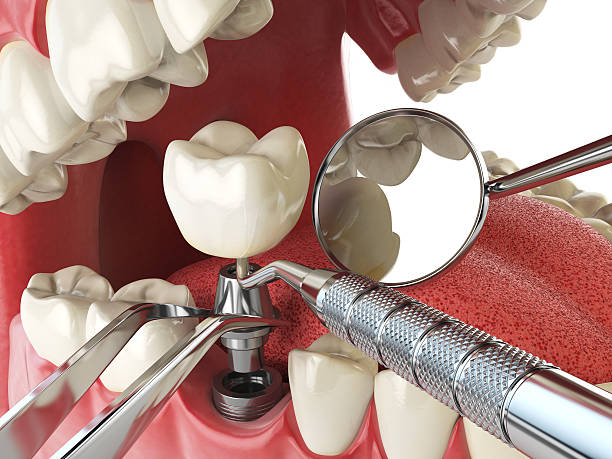Best Emergency Dental Care for Broken or Chipped Teeth in White Hall, AR