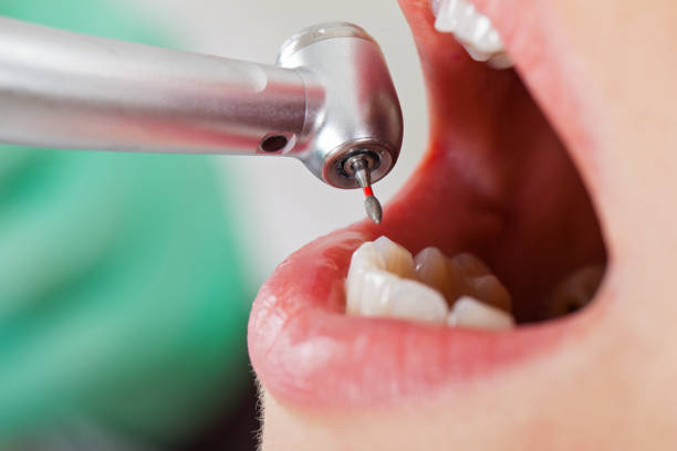 Best Emergency Denture Repair in White Hall, AR